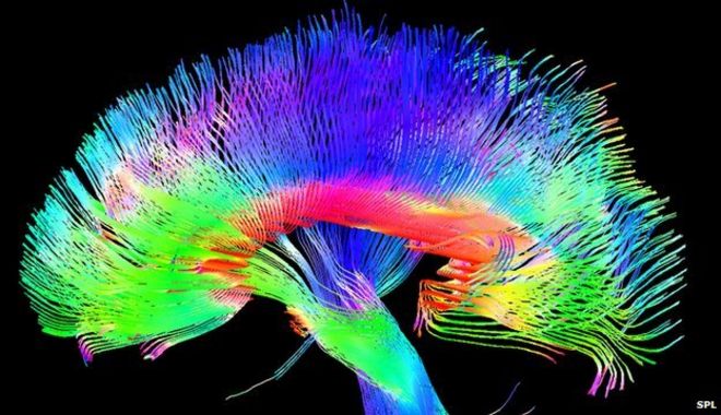 Coloured brain pathways