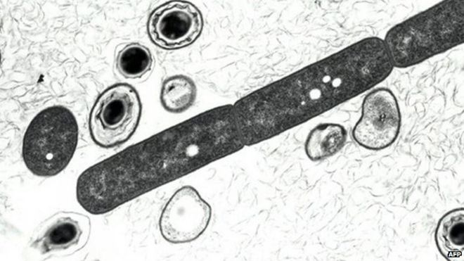 Бактерия сибирской язвы, показанная в 2001 году на фото Министерства обороны США