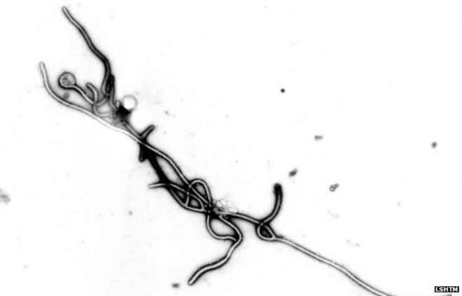 Вирус Эбола под электронным микроскопом (1977 г.)