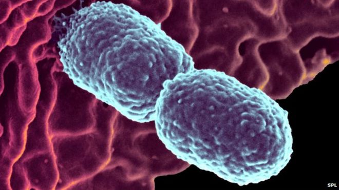 Бактерии Klebsiella pneumonia