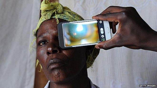 Приложение для здоровья глаз в Кении
