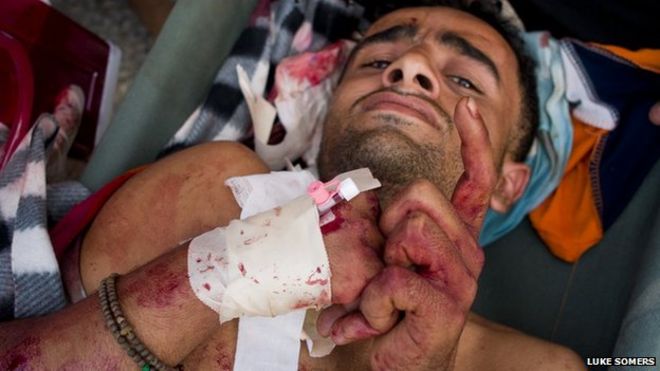 Окровавленный мужчина во временном госпитале в Санае 18 сентября 2011 года. Он был ранен, когда правительственные силы безопасности и вооруженные люди в штатском открыли огонь по демонстрации.