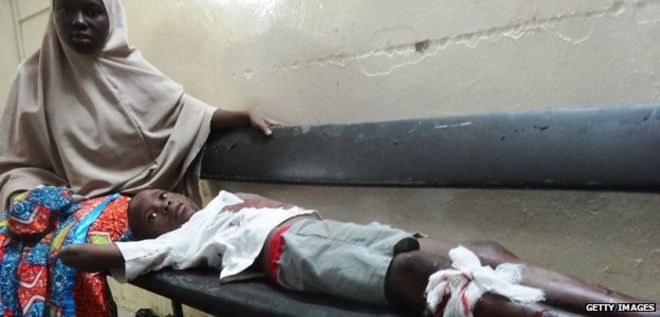 A boy injured in the Boko Haram attack on the central mosque in Kano