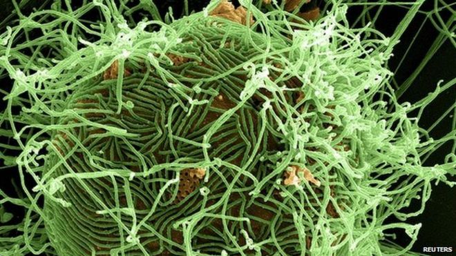 Частицы вируса Эбола в зеленом цвете, распадающиеся из хронически инфицированной клетки