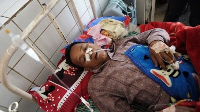 Мо Че Тхан, 48 лет, волонтер из Общества Красного Креста Мьянмы, отдыхает в больнице Лашио в северной части Мьянмы 19 февраля 2015 года, после того как его обстреляла Армия Национального демократического альянса Мьянмы (MNDAA)