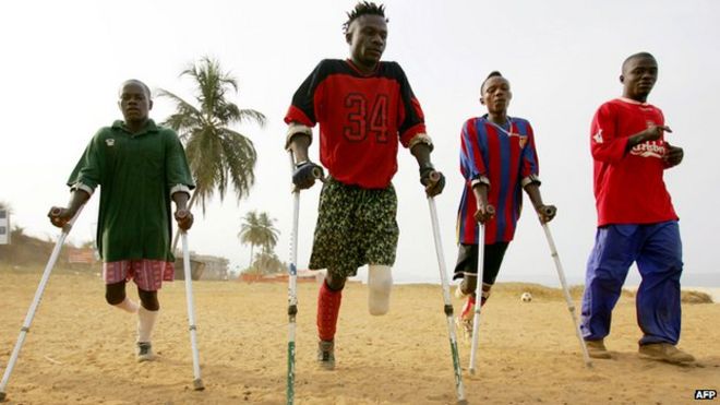 Люди с недостающими конечностями в Сьерра-Леоне