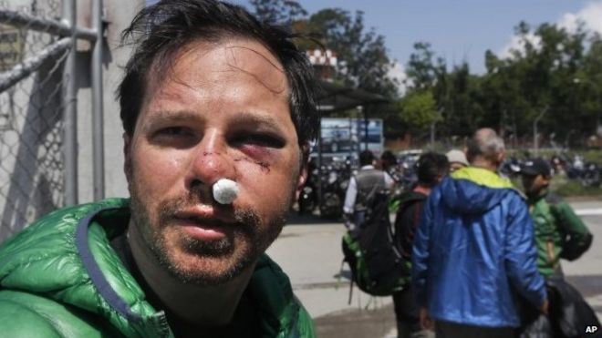 Гражданин США Майкл Чертон, 38 лет, из Нью-Йорка, который был ранен во время лавины, вызванной субботним землетрясением в базовом лагере горы Эверест, прибывает в аэропорт внутренних авиалиний в Катманду, Непал, в понедельник, 27 апреля 2015 года.