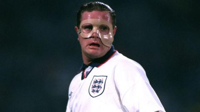 Paul Gascoigne played with a protective mask during a World Cup Qualifier against Poland in 1993