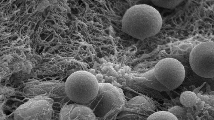Microscopic picture of spherical super clotting particles
