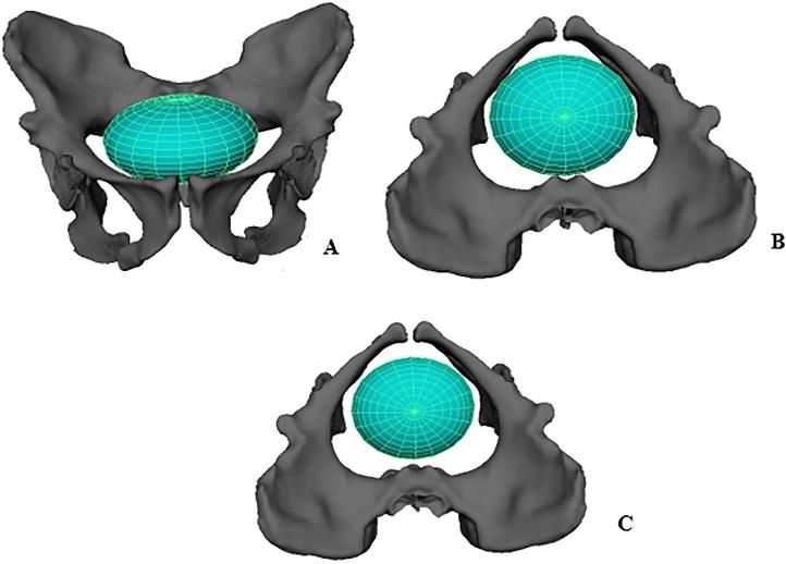 Reconstructing birth in Australopithecus sediba