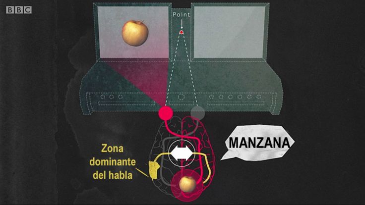 Panel mostrando manzana a la izquierda y cerebro de persona normal identificándola