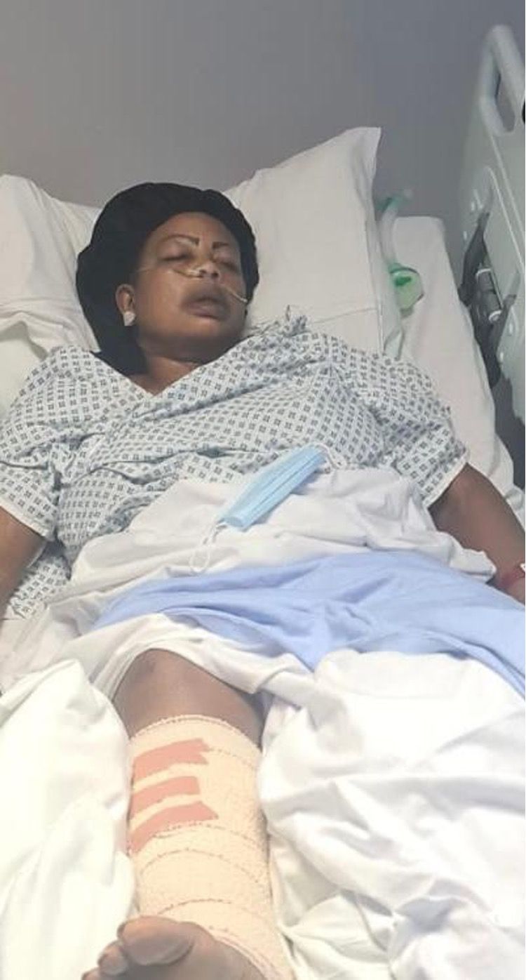 Lucy Daramola in hospital with bandaged legs