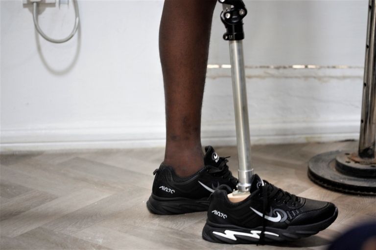 A prosthetic leg is affixed for a child at the Irede Prosthetic Centre in the Ogudu district, Lagos, Nigeria, 07 October 2022. The Irede Foundation is a non-governmental organisation focused on encouraging children ages 0-18, living with limb loss, either acquired or congenital, to live a life of fulfillment, and to inspire action so a child amputee can live independently through the provision of a prosthetic limb. Of the world"s population, at least one billion people, have some form of disability, whether present at birth or acquired later in life. Nearly 240 million of them are children, according to UNICEF.