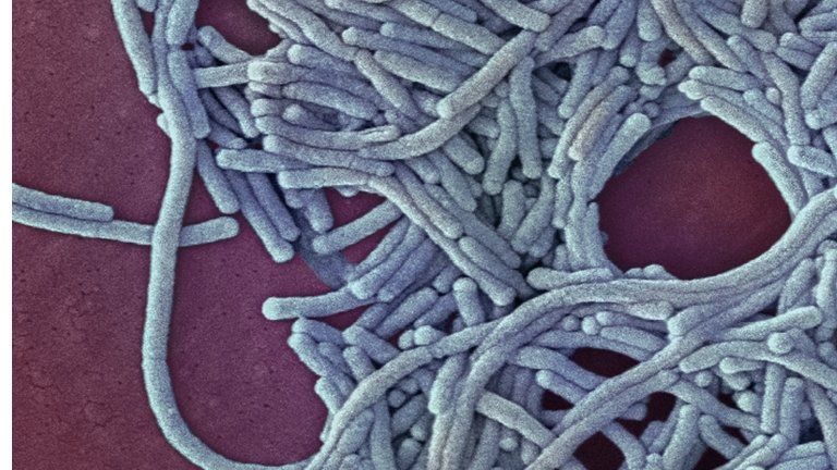 Coloured light micrograph of Legionella pneumophila bacteria, the cause of Legionnaires' disease.