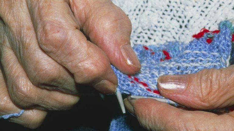 Elderly woman affected by osteoarthritis