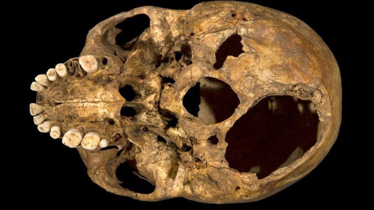 Richard III's skull