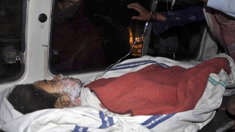Amina Bibi, who was injured after setting herself on fire, lies in an ambulance after being taken to a hospital for treatment in Multan, Pakistan, on 13 March 2014