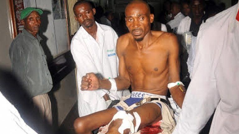Wounded man arrives at hospital in Mombasa (3 May 2014)