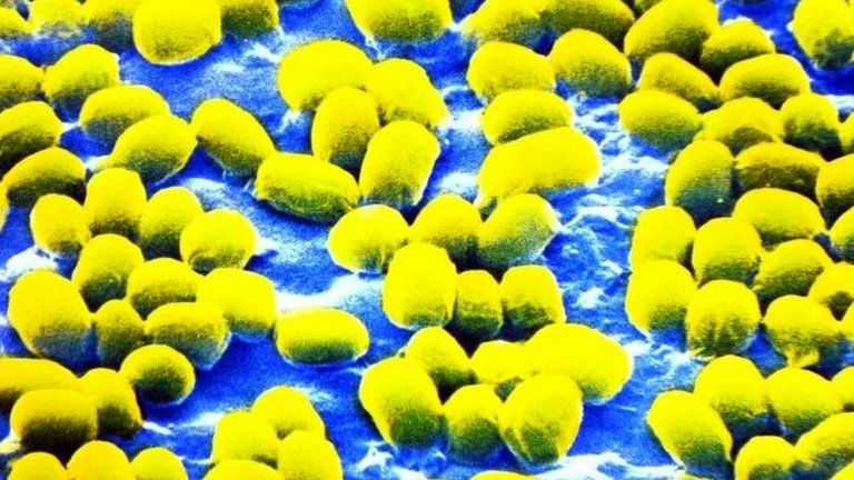 Close up microscopic pictures of the Anthrax virus