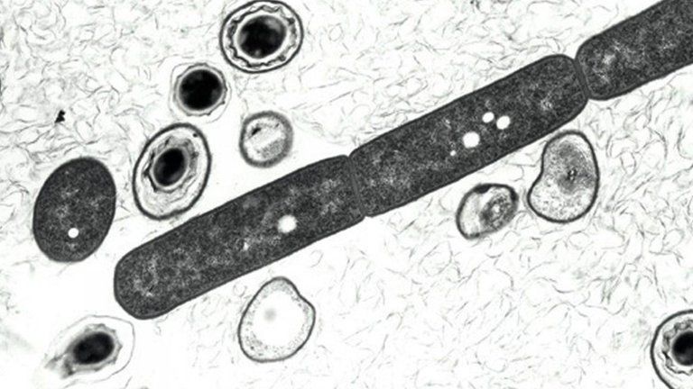Anthrax bacterium, shown in a 2001 US defence department photo