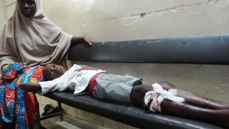 A woman sits beside an injured boy at a hospital in Kano, 28 November
