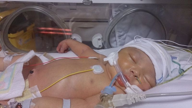 Legal action over Coventry baby's sepsis death - BBC News