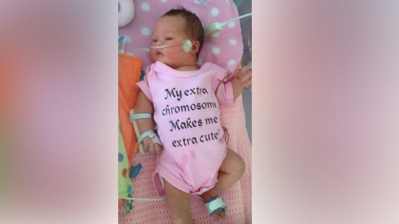Doctors Pressured Mom 15 Times to Abort Because Her Baby Has Down Syndrome, She Refused