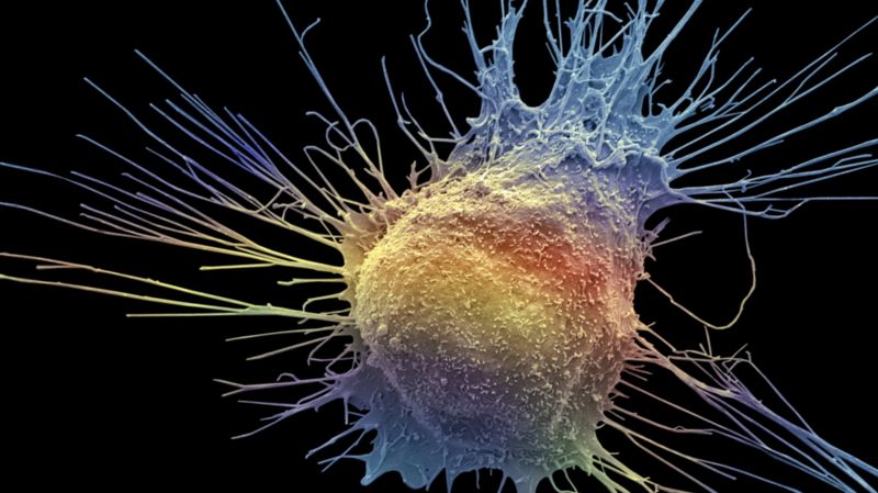 Huge Leap In Prostate Cancer Testing Bbc News 3086