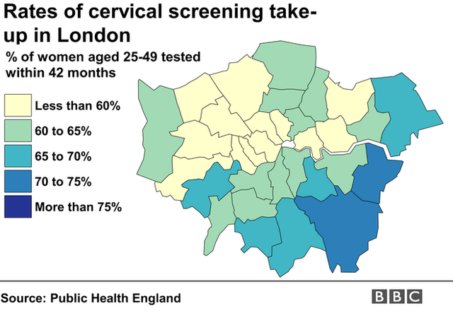 Cervical screening: Millions missing smear tests - BBC News