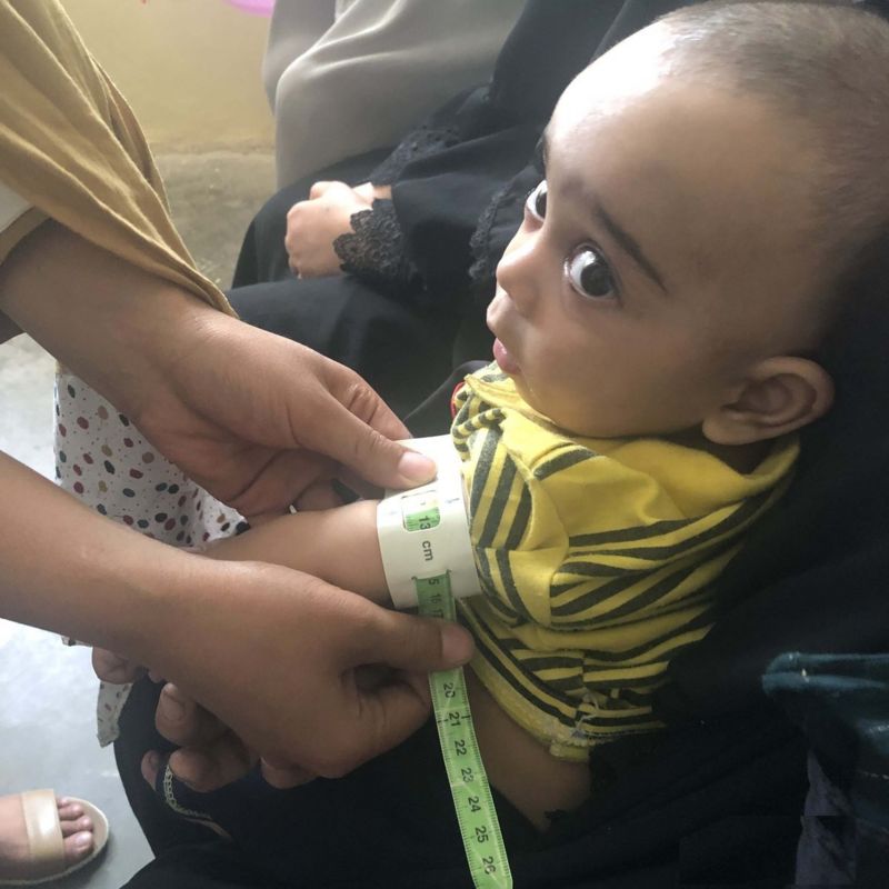 یونیسف نزدیک به دو میلیون کودک در افغانستان دچار سوء تغذیه هستند Bbc 