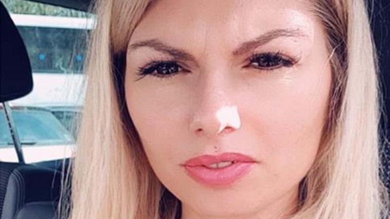 Louise Harvey breast surgery death 'unanswered questions' - BBC News