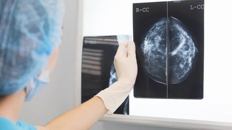 Día Mundial contra el Cáncer: prevención de cáncer de mama Día Mundial contra el Cáncer: prevención de cáncer de mama