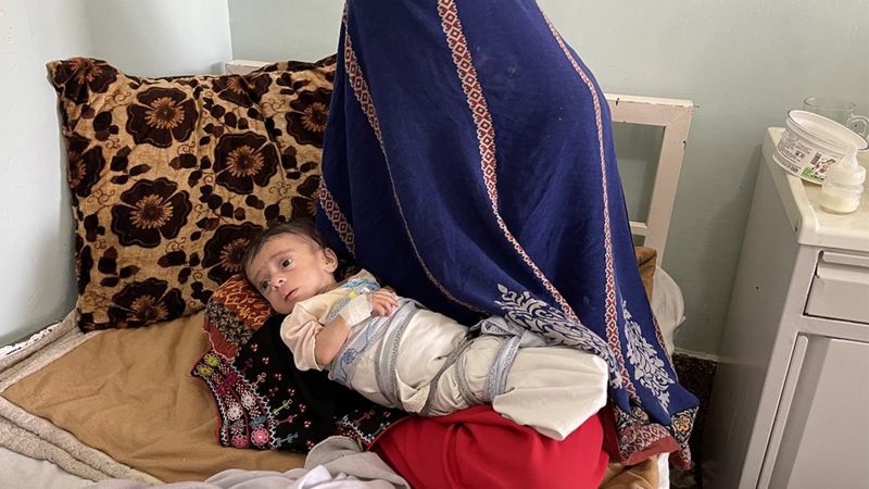 Bayi-bayi Afghanistan kelaparan akibat krisis, rumah sakit kesulitan - 'Rasanya seperti di neraka'