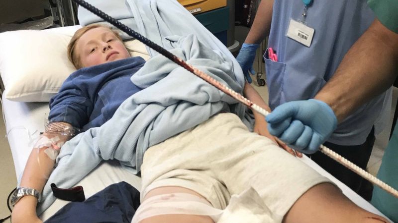 Irish Open Boy Impaled On Metal Rod At Car Park Bbc News 7504