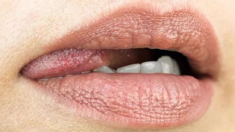bahaya-seks-oral