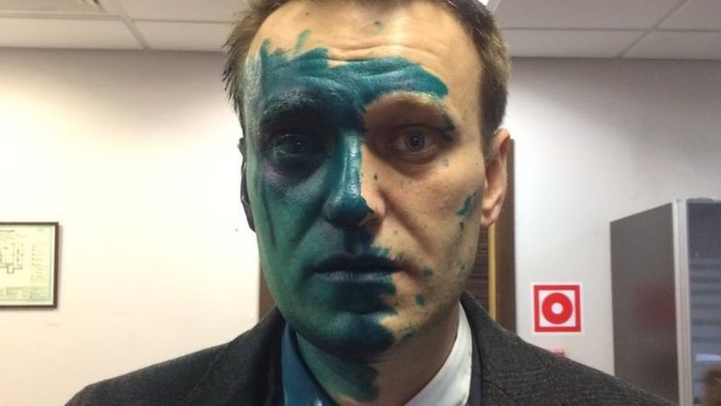 Russia Opposition Leader Alexei Navalny Attacked With Brilliant Green 