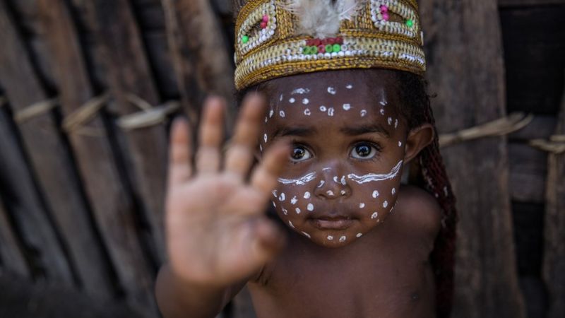 Gizi buruk dan campak, puluhan tewas di Papua pemerintah lambat? BBC