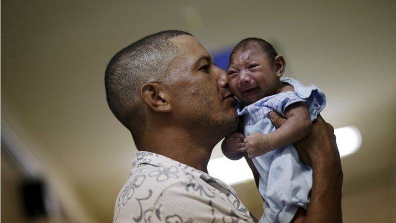 Zika Virus And Microcephaly Your Questions Answered Bbc News 3029