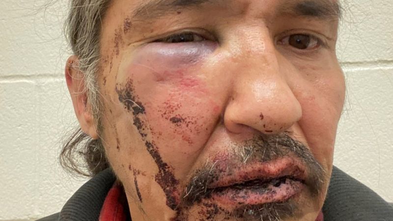 El Violento Arresto De Un Jefe Indgena En Canad Que Conmociona Al