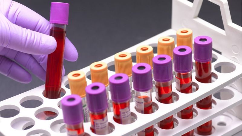 Multi-cancer Blood Test Shows Real Promise In NHS Study - BBC News