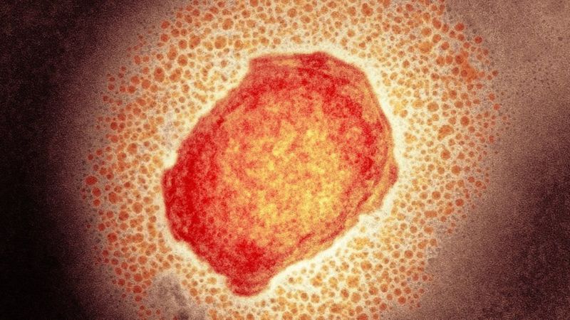 Qué Es La Viruela De Los Monos La Rara Infección Que Descubrieron En Un Paciente En Reino 0543