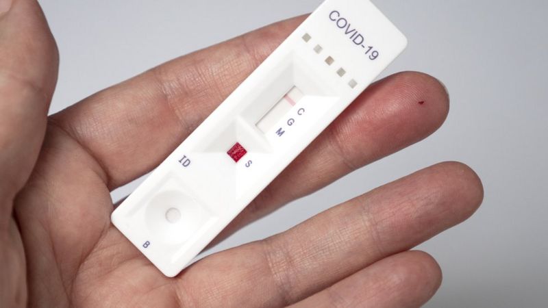 Teste Rápido Após Vacina Contra Covid 4 Razões Para Fugir Dele