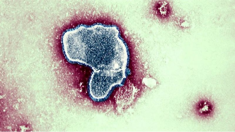 Cold virus killed 100,000 children globally in 2019 - BBC News