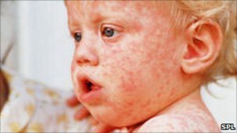 more-parents-than-ever-in-ni-choose-to-give-children-mmr-jab-bbc-news