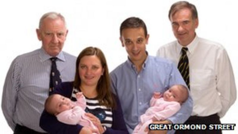 Conjoined Twins Rosie And Ruby Formosa Separated Bbc News