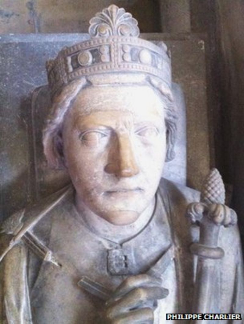 Richard the Lionheart's mummified heart analysed BBC News