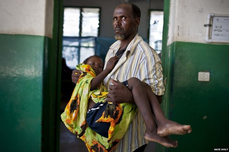 In pictures: Fighting deadly child diseases in Somalia - BBC News