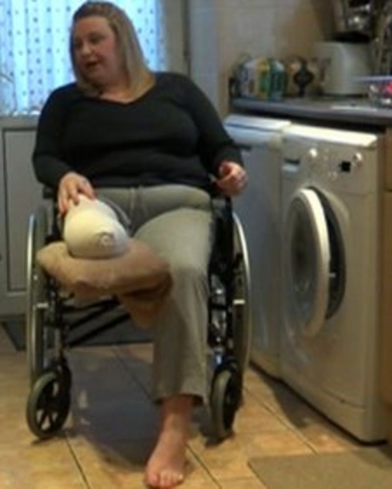 Woman who lost leg pleads for driver to come forward BBC News