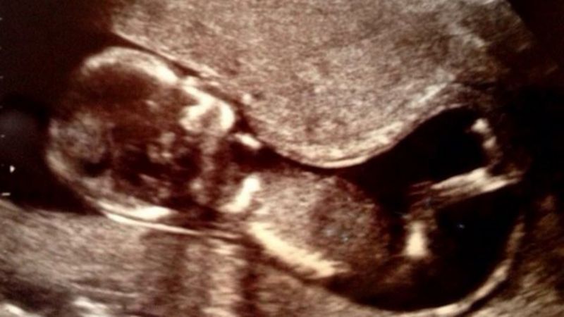 How Much Do Women Around The World Pay To Give Birth BBC News