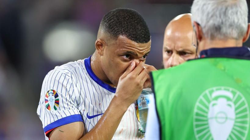 Kylian Mbappe after breaking his nose in France's 1-0 win against Austria